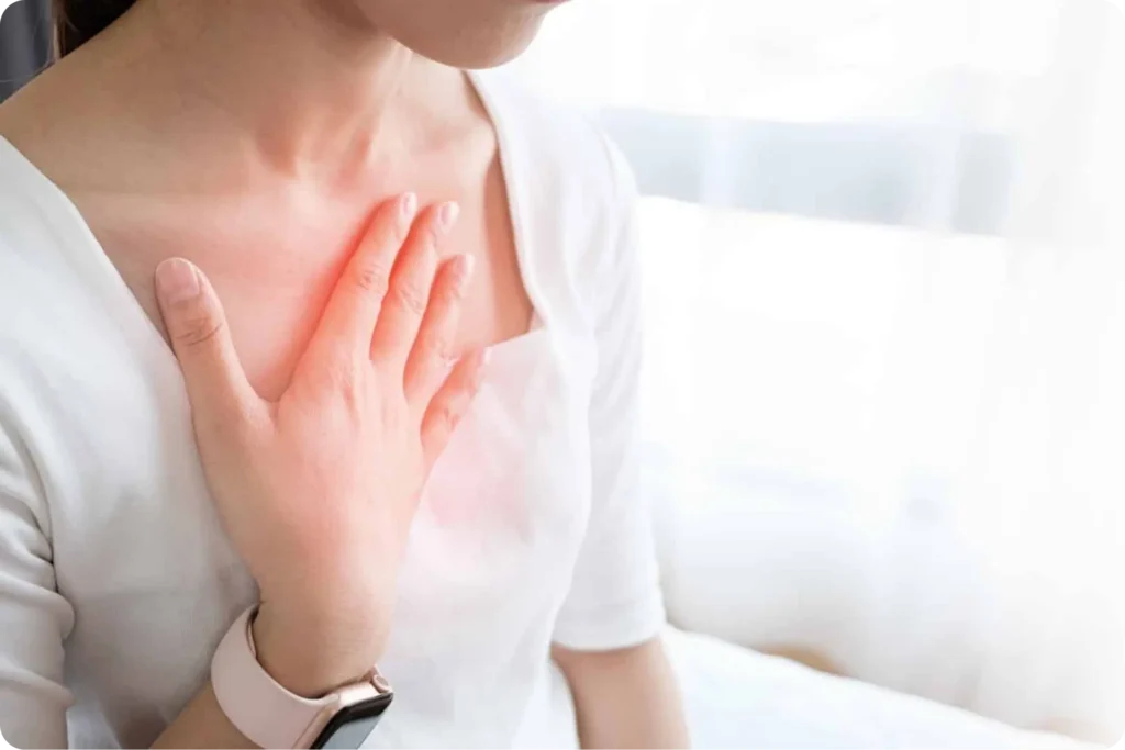 Esophagitis
