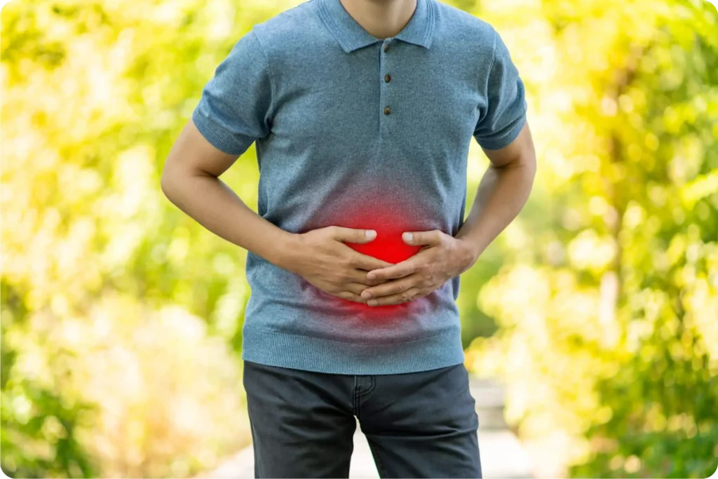 Ulcerative Colitis